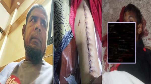 বরিশালে আনসার বাহিনীর গাড়িচাপায় শিশু নি’হত