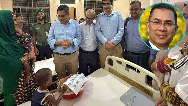 হামে আক্রান্ত যমজ শিশুর পাশে প্রধানমন্ত্রী