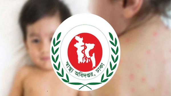 হামের উপসর্গ নিয়ে আরও ৬ শিশুর মৃত্যু