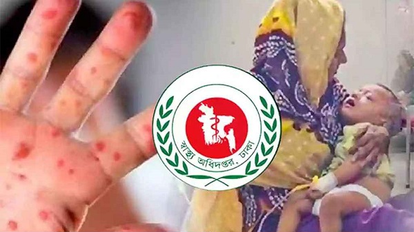 হাম ও হামের উপসর্গ নিয়ে আরও ৯ শিশুর মৃত্যু