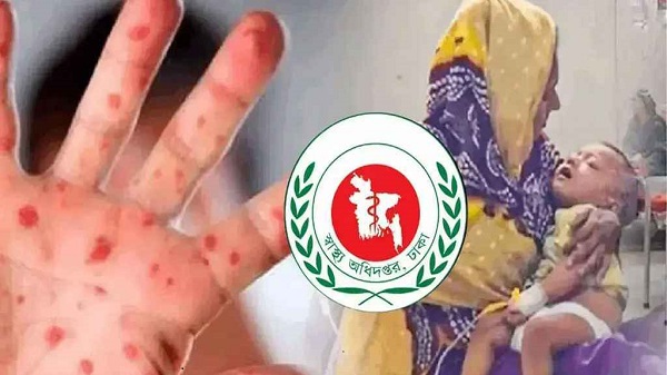 হাম উপসর্গ নিয়ে একদিনে আরও ৮ জনের মৃত্যু