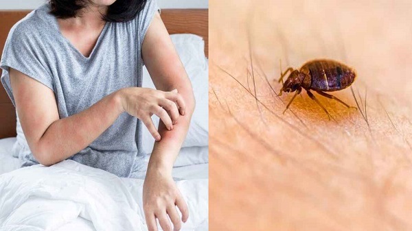 ছারপোকা থেকে রক্ষা পেতে যা জানা জরুরি
