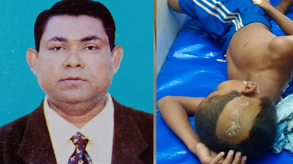 শ্যামনগরে স্কুলের পানির ট্যাংক পরিষ্কার করতে গিয়ে বিদ্যুৎস্পৃষ্ট শিক্ষার্থী আহত